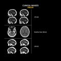 Anatom 32Fit Multi-Slice Spiral CT Scan....