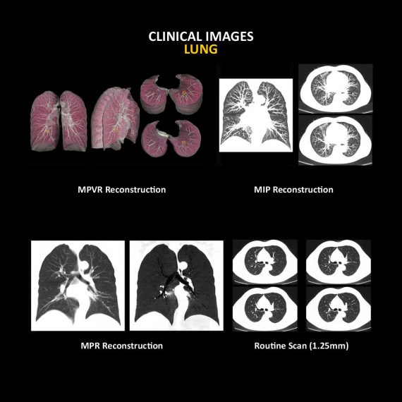 Anatom 32Fit Multi-Slice Spiral CT Scan......