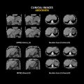 Anatom 32Fit Multi-Slice Spiral CT Scan........