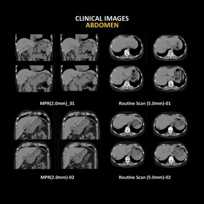 Anatom 32Fit Multi-Slice Spiral CT Scan........