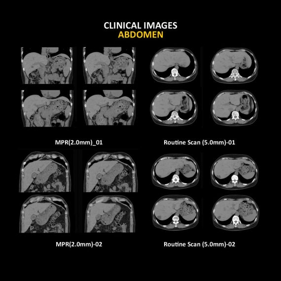 Anatom 32Fit Multi-Slice Spiral CT Scan........