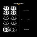 ANATOM 16 Deluxe Edition 32 row 16 Slice CT Scan..