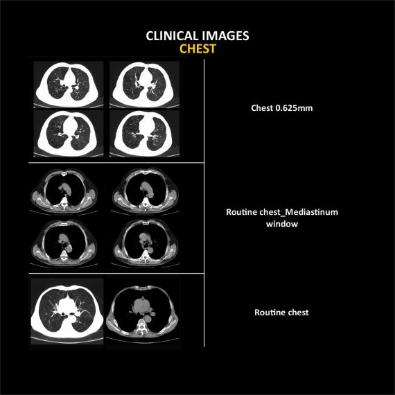 ANATOM 16 Deluxe Edition 32 row 16 Slice CT Scan..