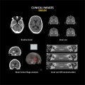 ANATOM 16 Deluxe Edition 32 row 16 Slice CT Scan....