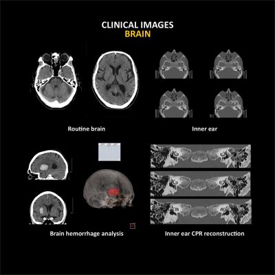 ANATOM 16 Deluxe Edition 32 row 16 Slice CT Scan....