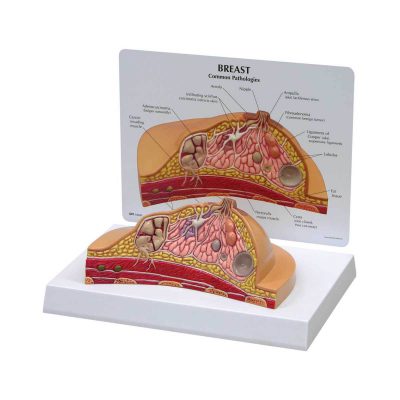 Breast Cross-Section Model