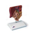 Gallstone Model - 3B Smart Anatomy..