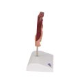 Gallstone Model - 3B Smart Anatomy....