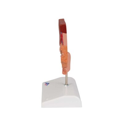 Gallstone Model - 3B Smart Anatomy......