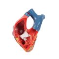 Life-Size Human Heart Model, 5 parts with Representation of Systole - 3B Smart Anatomy..........