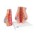 Model of Female Breast with Healthy & Unhealthy Tissue - 3B Smart Anatomy..