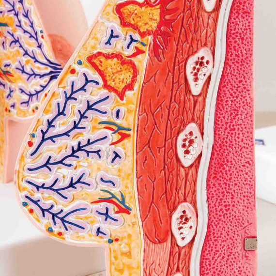 Model of Female Breast with Healthy & Unhealthy Tissue - 3B Smart Anatomy......