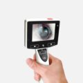 Digital Otoscope with Camera2