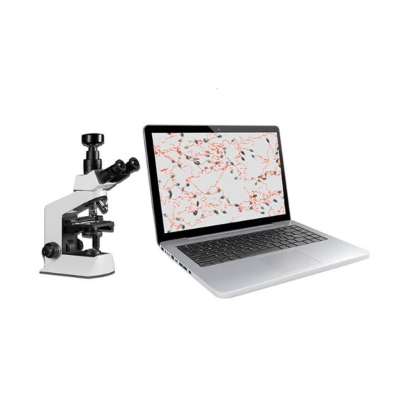 SW-3702 Laptop Sperm Quality Analyzer