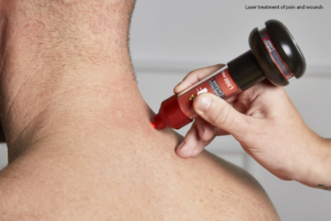 laser-therapy-treatment-300x200