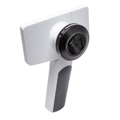 Riester_RCS-100_dermatoscope_web-removebg-preview