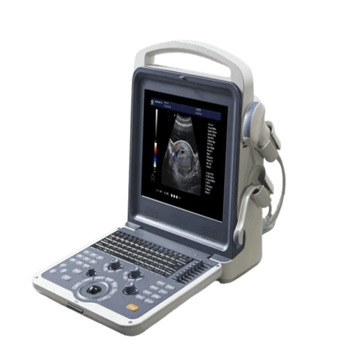 8-ultrasound-machine_04-removebg-preview-1