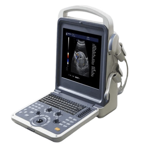8-ultrasound-machine_14-removebg-preview-1