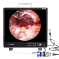 9119-Ent-Endoscopy-Machine-Endoscopic_73250