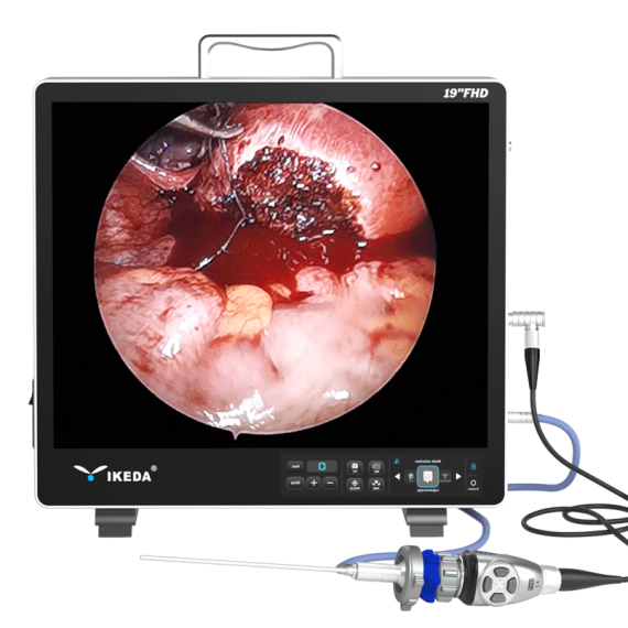 9119-Ent-Endoscopy-Machine-Endoscopic_73250