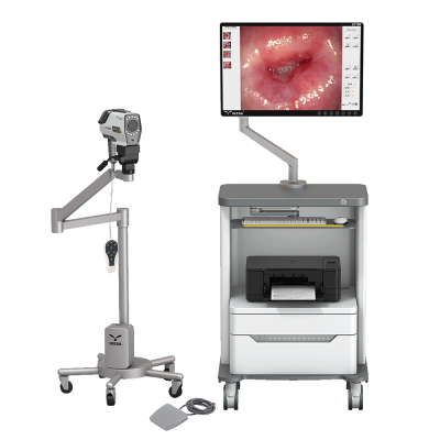 Digital-Video-Colposcope_73116