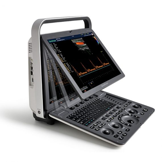 S8 Portable Ultrasound Scanner