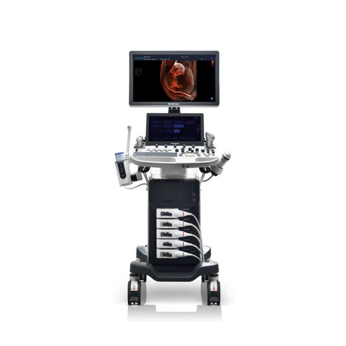 Radiology Ultrasound Scanner Machine - Sonoscanner