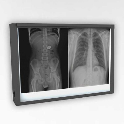 Double X-ray Viewing Box