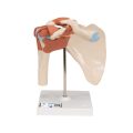 Functional Human Shoulder Joint - 3B Smart Anatomy..