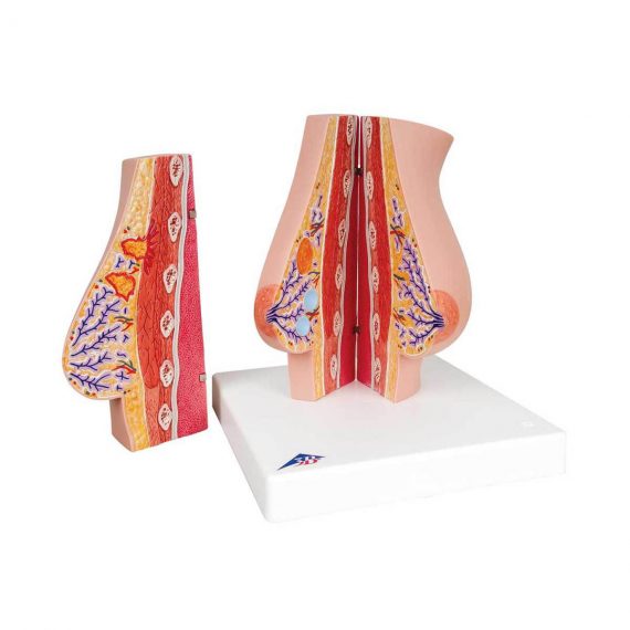 Model of Female Breast with Healthy & Unhealthy Tissue - 3B Smart Anatomy..
