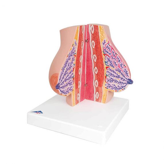 Model of Female Breast with Healthy & Unhealthy Tissue - 3B Smart Anatomy....