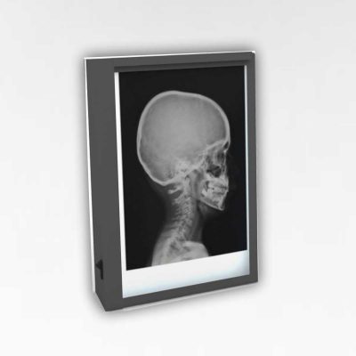 Single X-ray Viewing Box