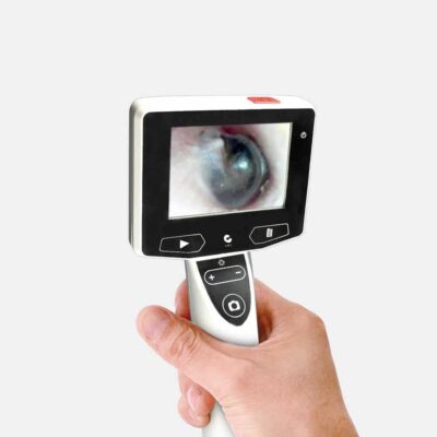 Digital Otoscope with Camera2