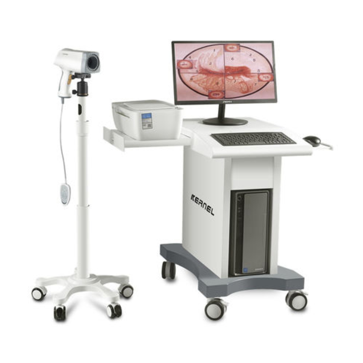 KN 2200 Video Colposcope HALOMEDICALS SYSTEMS LIMITED   Kn 2200 Colposcope 