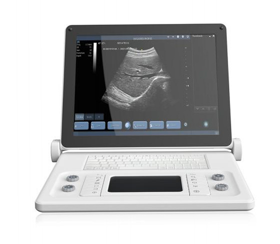 Youkey_F6_Ultrasound_Machine_Scanner_Front_View_3