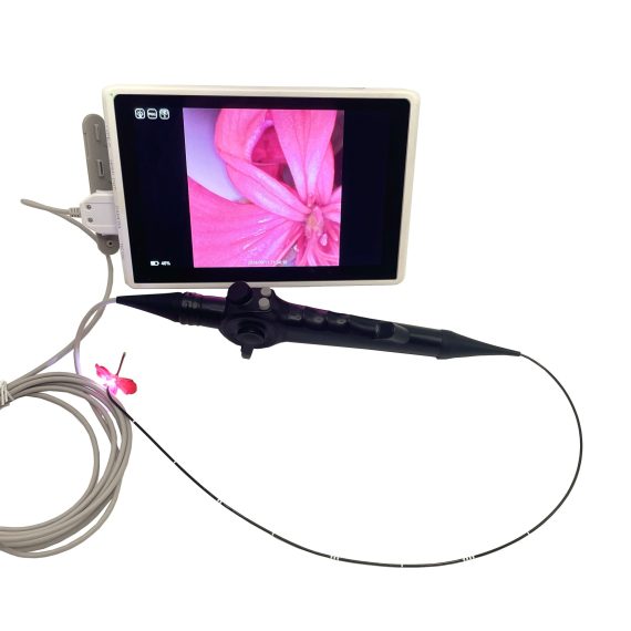 Electronic bronchoscopy1
