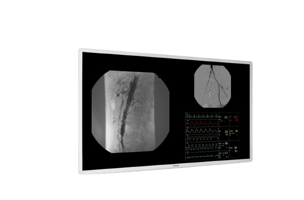 MDAC-8355-persp-left-screen03-small-jpg-removebg-preview