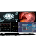 MDSC-8255-front-transp-removebg-preview