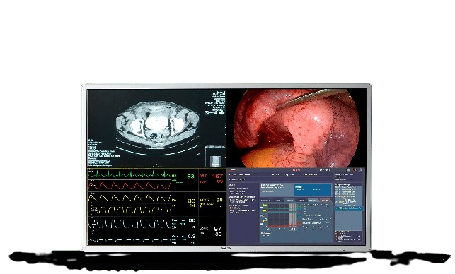 MDSC-8255-front-transp-removebg-preview
