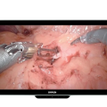 MDSC-8527-front-onwhite-removebg-preview