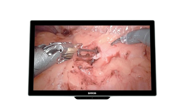 MDSC-8527-front-onwhite-removebg-preview