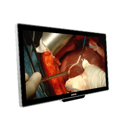 MDSC-8527-left-persp-transp-removebg-preview
