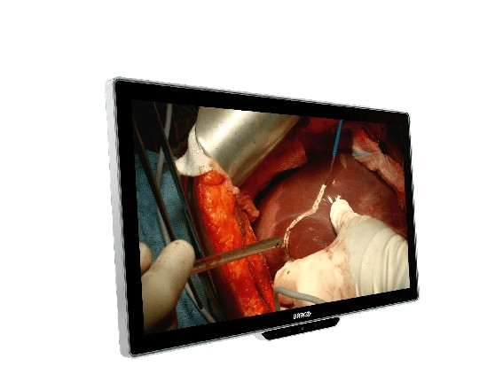 MDSC-8527-left-persp-transp-removebg-preview