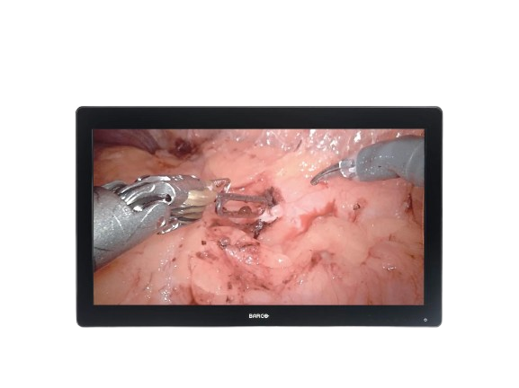MDSC_8232-front-wscreen-small-jpg-removebg-preview