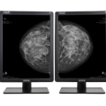Nio-58MP-Gray-dualhead-mammopreview-jpg-removebg-preview