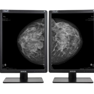Nio-58MP-Gray-dualhead-mammopreview-jpg-removebg-preview
