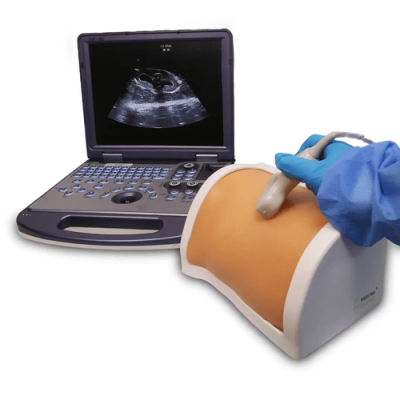 Training model of percutaneous nephrolithotomy ultrasound puncture