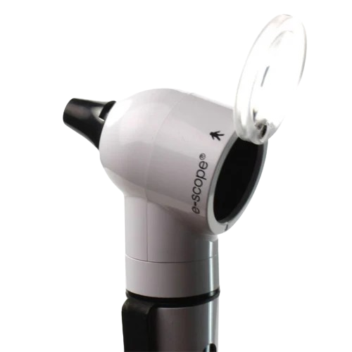 Riester_e-scope_otoscope_FO_white_detail_web-removebg-preview